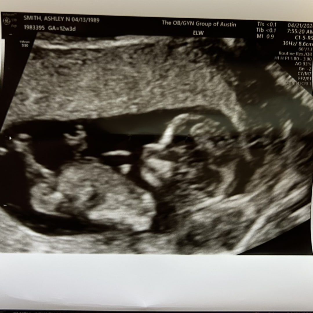 Photo shared by Ashley for their Babylist baby registry.