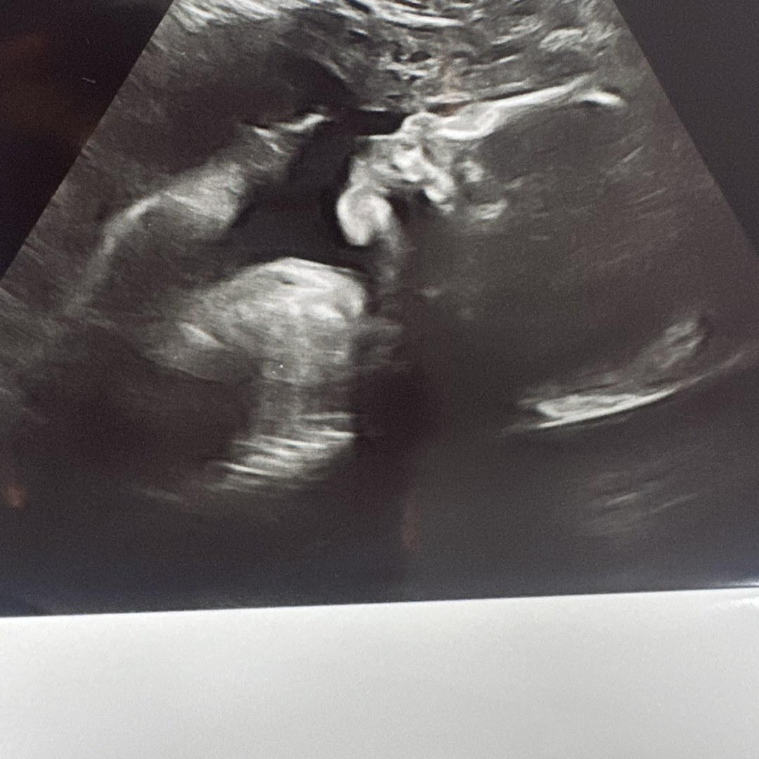 Photo shared by Celeste for their Babylist baby registry.