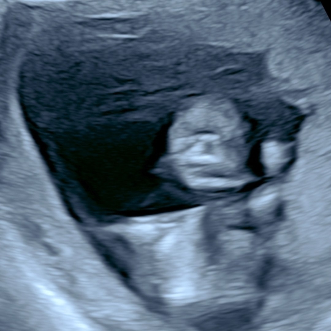 Photo shared by Blayne for their Babylist baby registry.