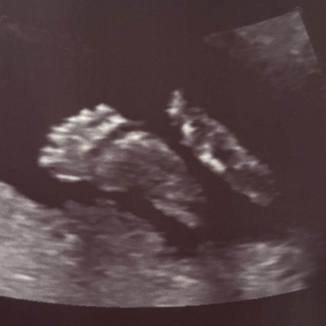 Photo shared by Zoe for their Babylist baby registry.