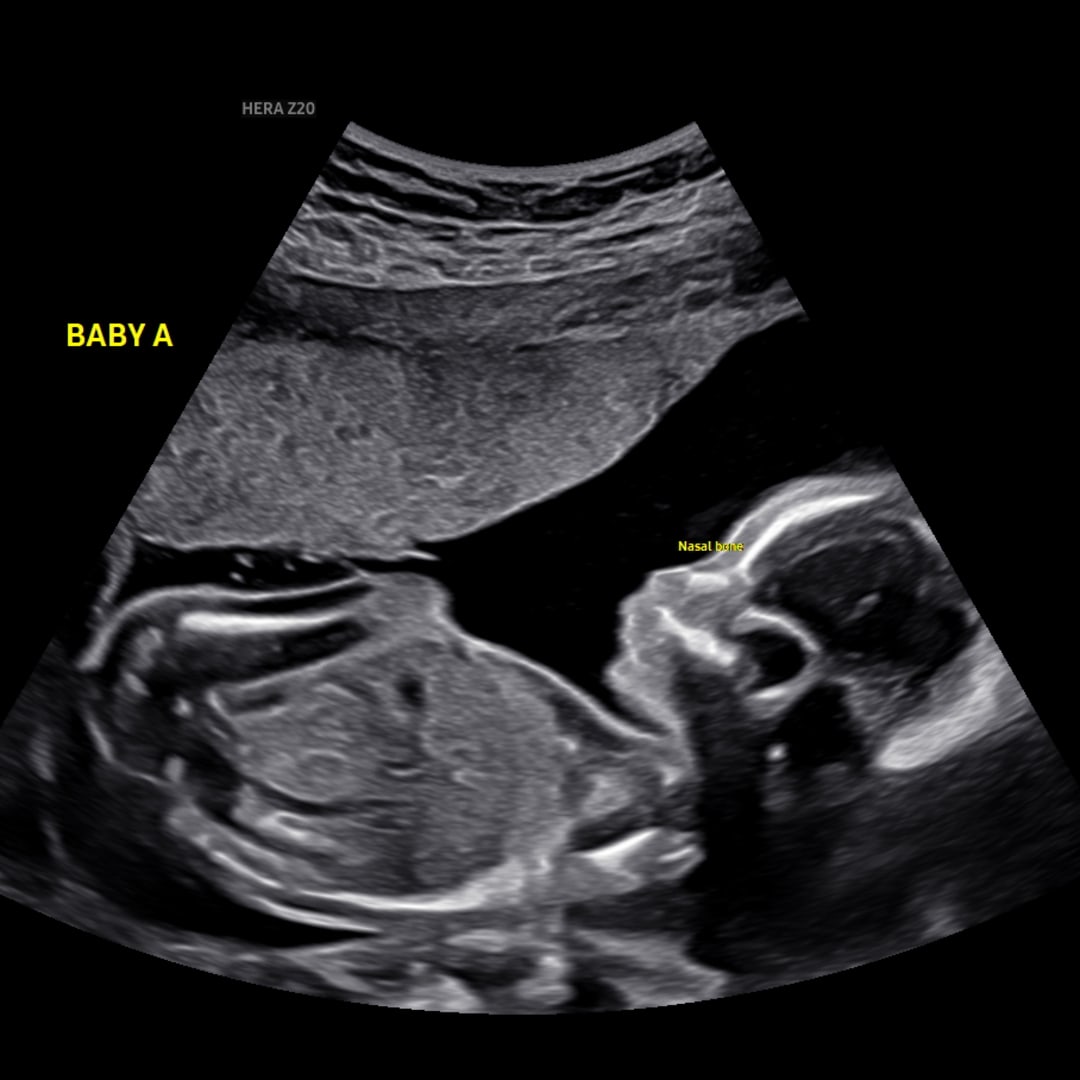Photo shared by Ali for their Babylist baby registry.