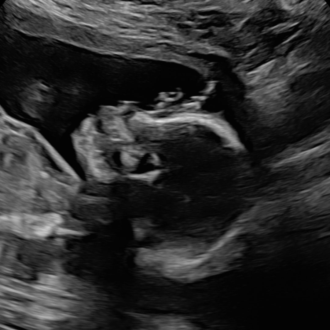 Photo shared by Kortney for their Babylist baby registry.