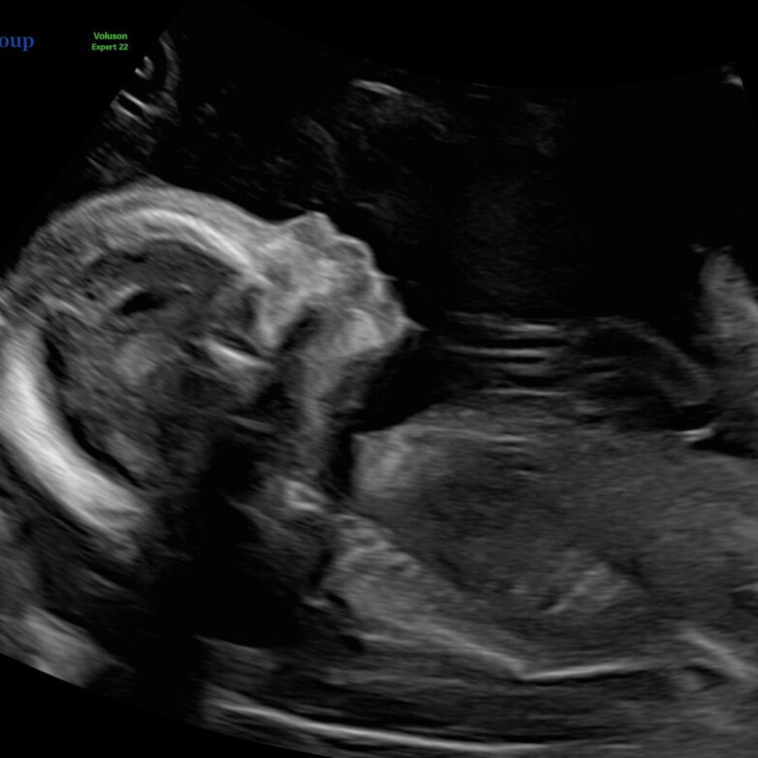 Photo shared by Gloria for their Babylist baby registry.