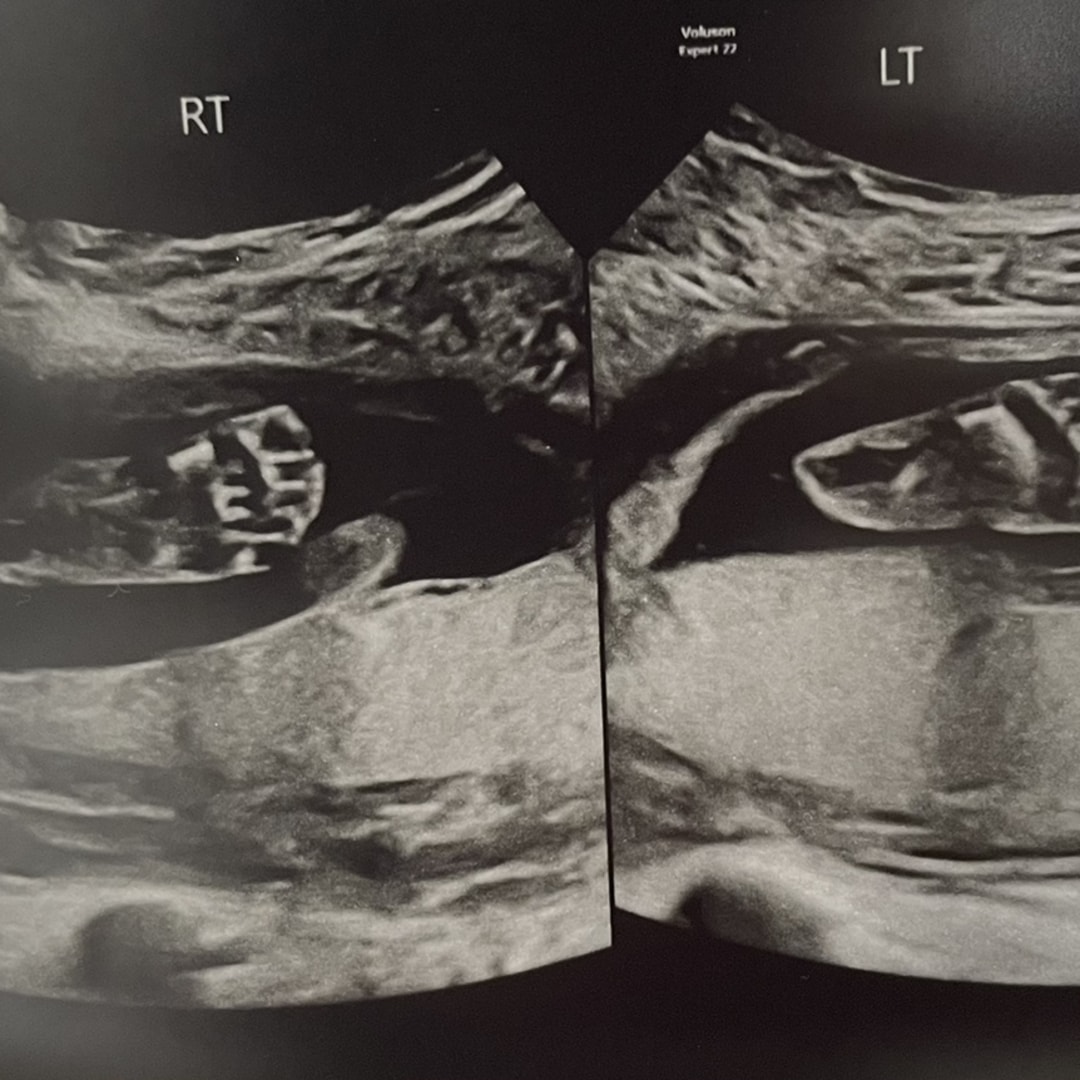 Photo shared by Abbey for their Babylist baby registry.