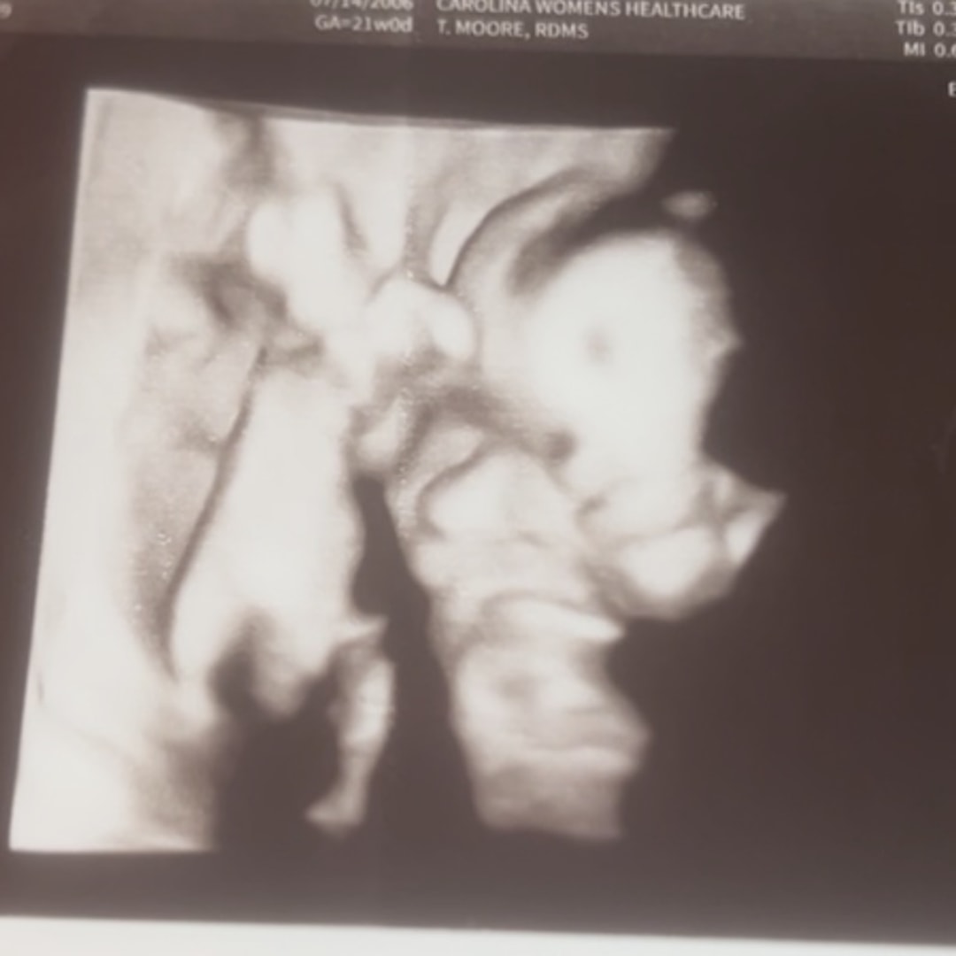 Photo shared by Zoe for their Babylist baby registry.