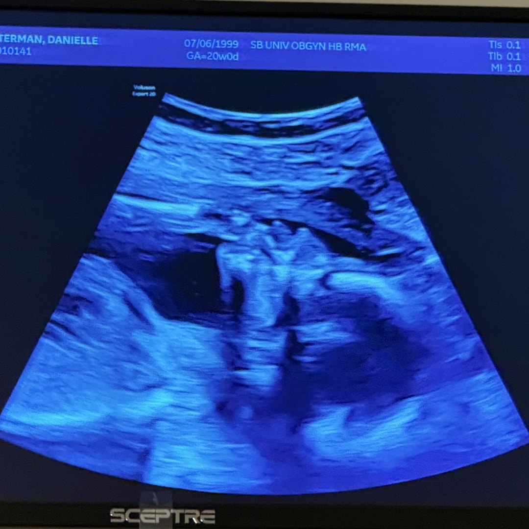 Photo shared by Danielle for their Babylist baby registry.