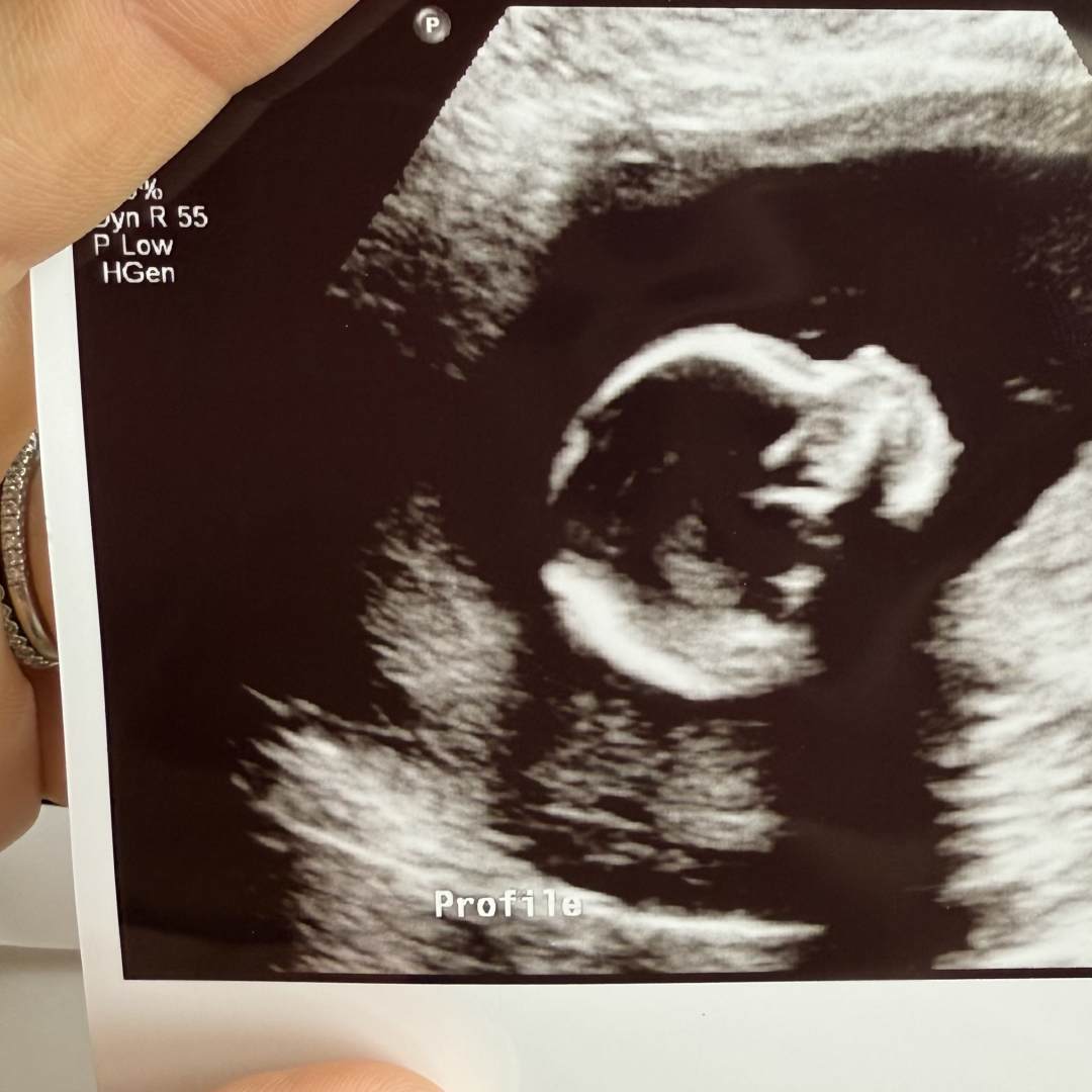 Photo shared by Slade for their Babylist baby registry.