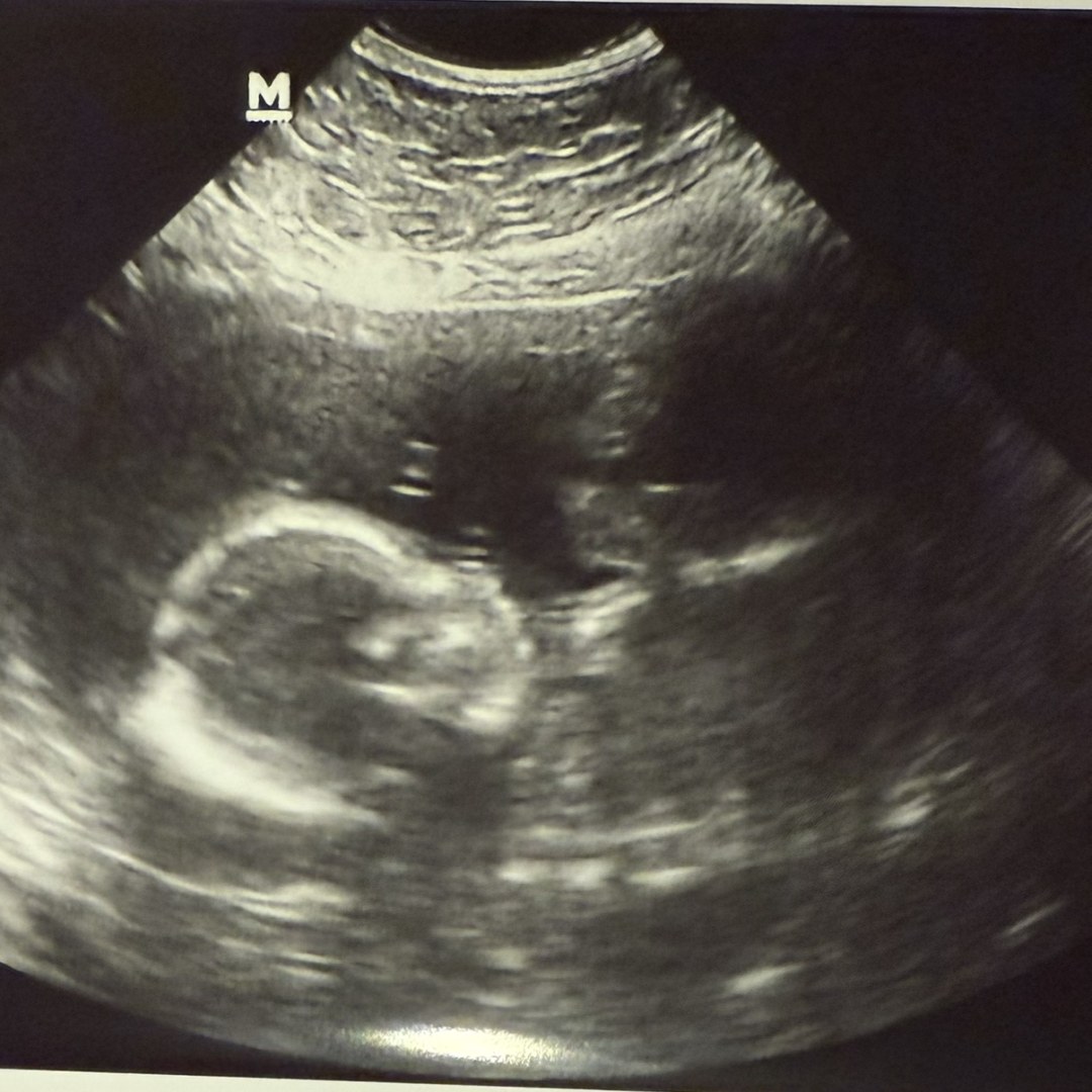 Photo shared by Carolina for their Babylist baby registry.