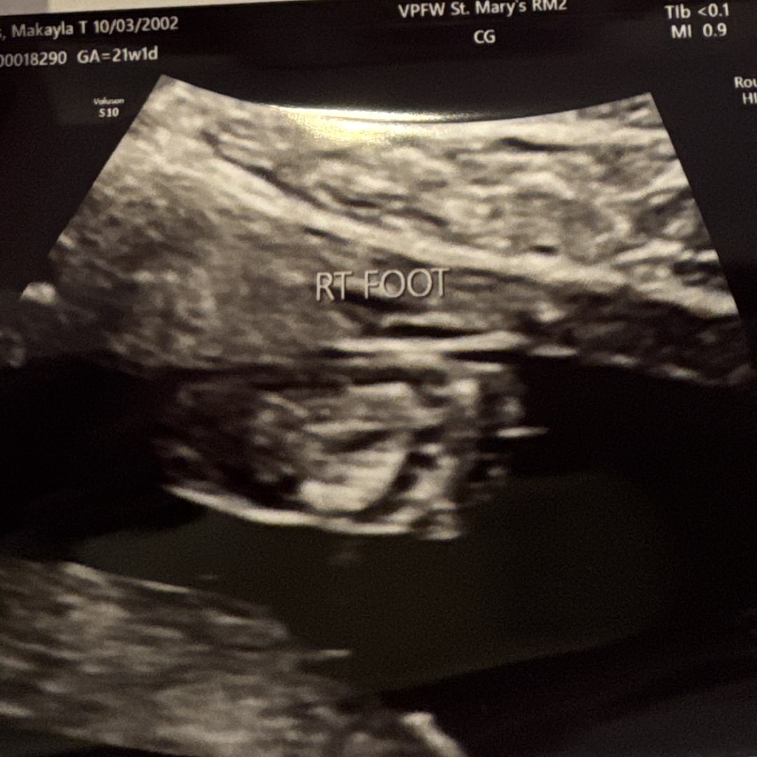 Photo shared by MaKayla for their Babylist baby registry.