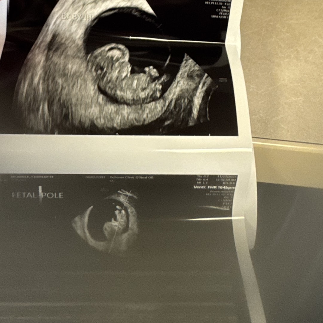 Photo shared by Charlotte for their Babylist baby registry.