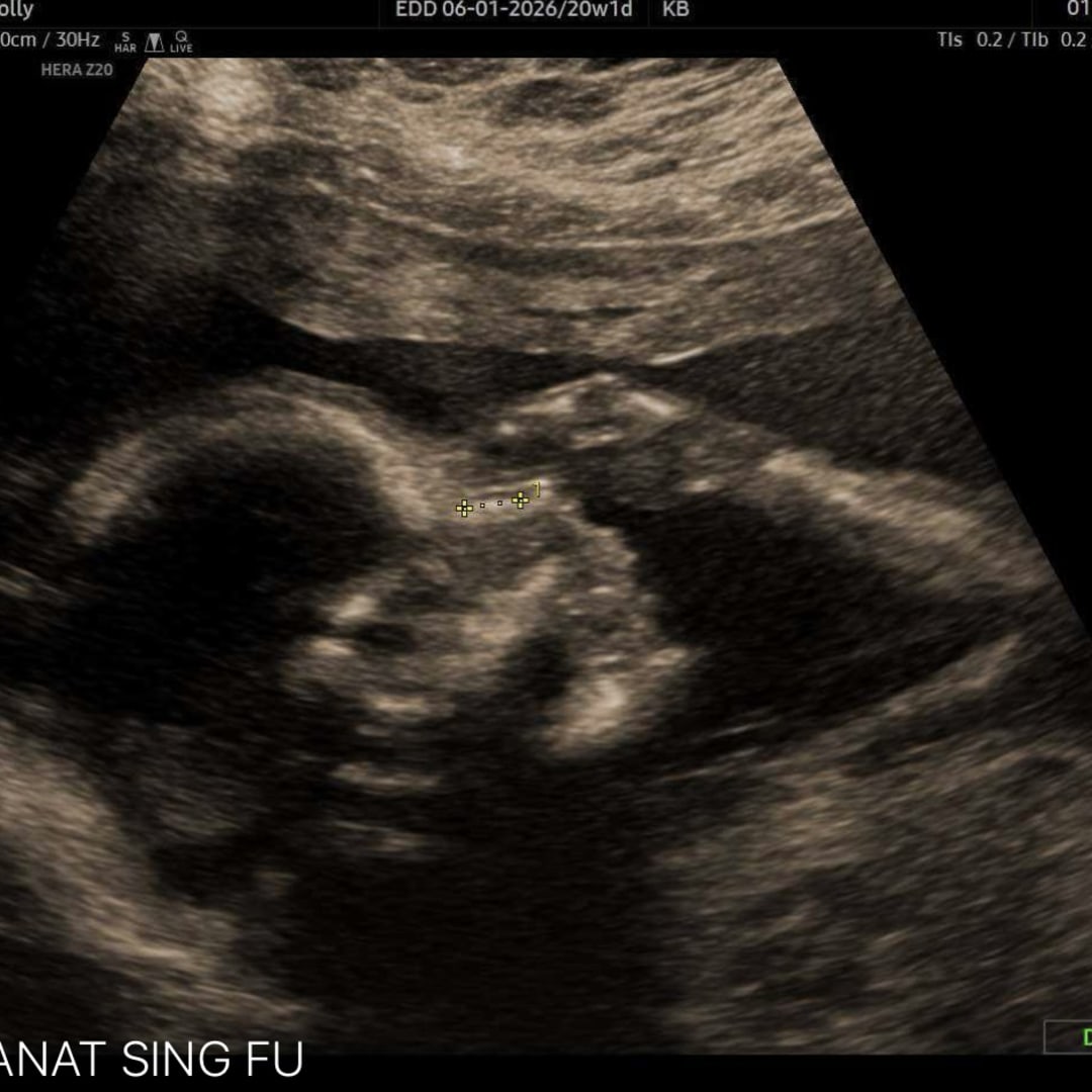 Photo shared by Holly for their Babylist baby registry.