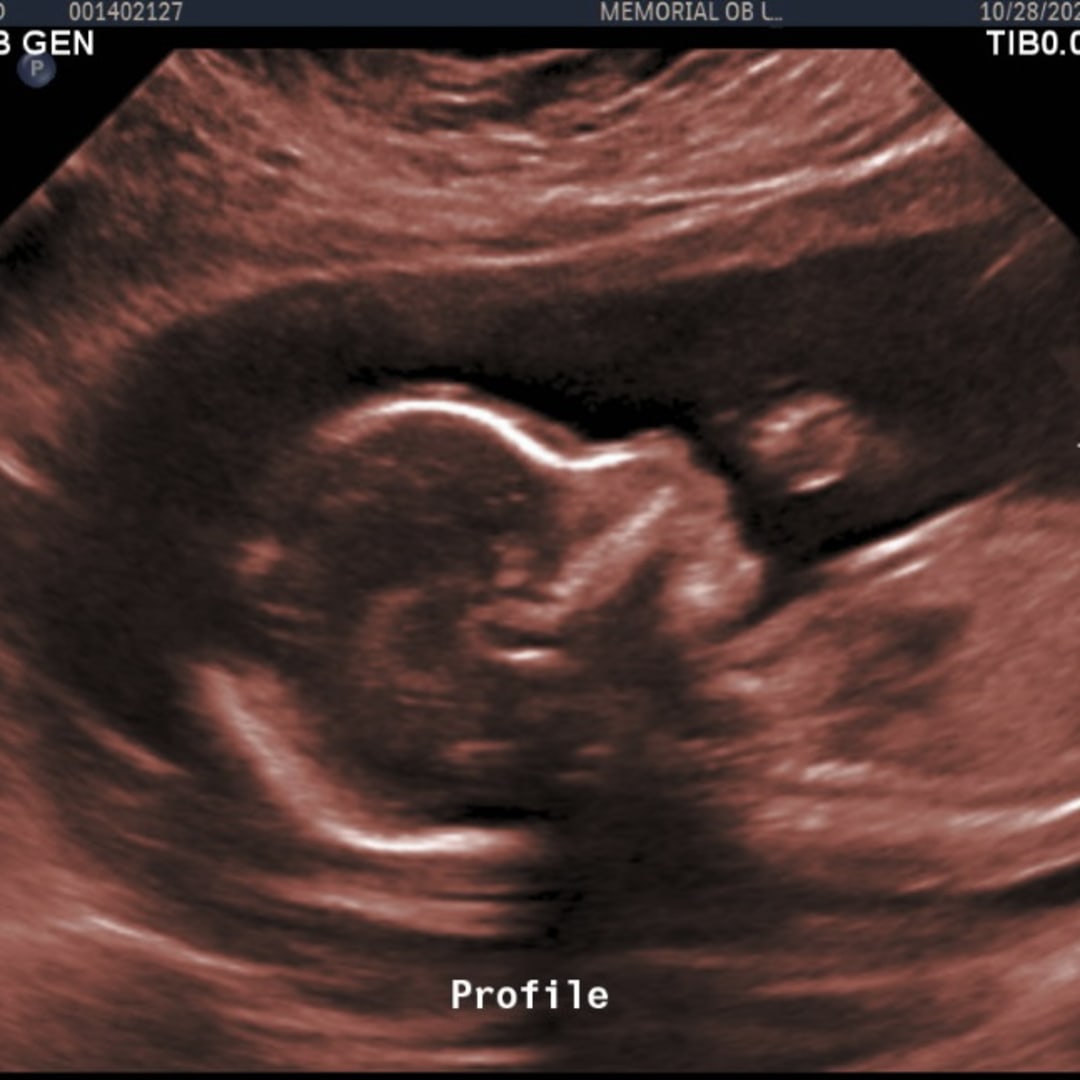 Photo shared by Colbie for their Babylist baby registry.