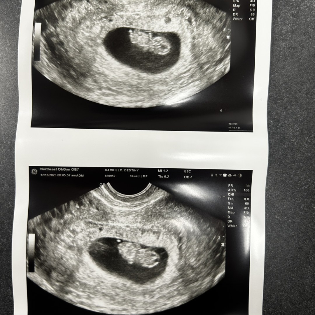 Photo shared by Destiny for their Babylist baby registry.