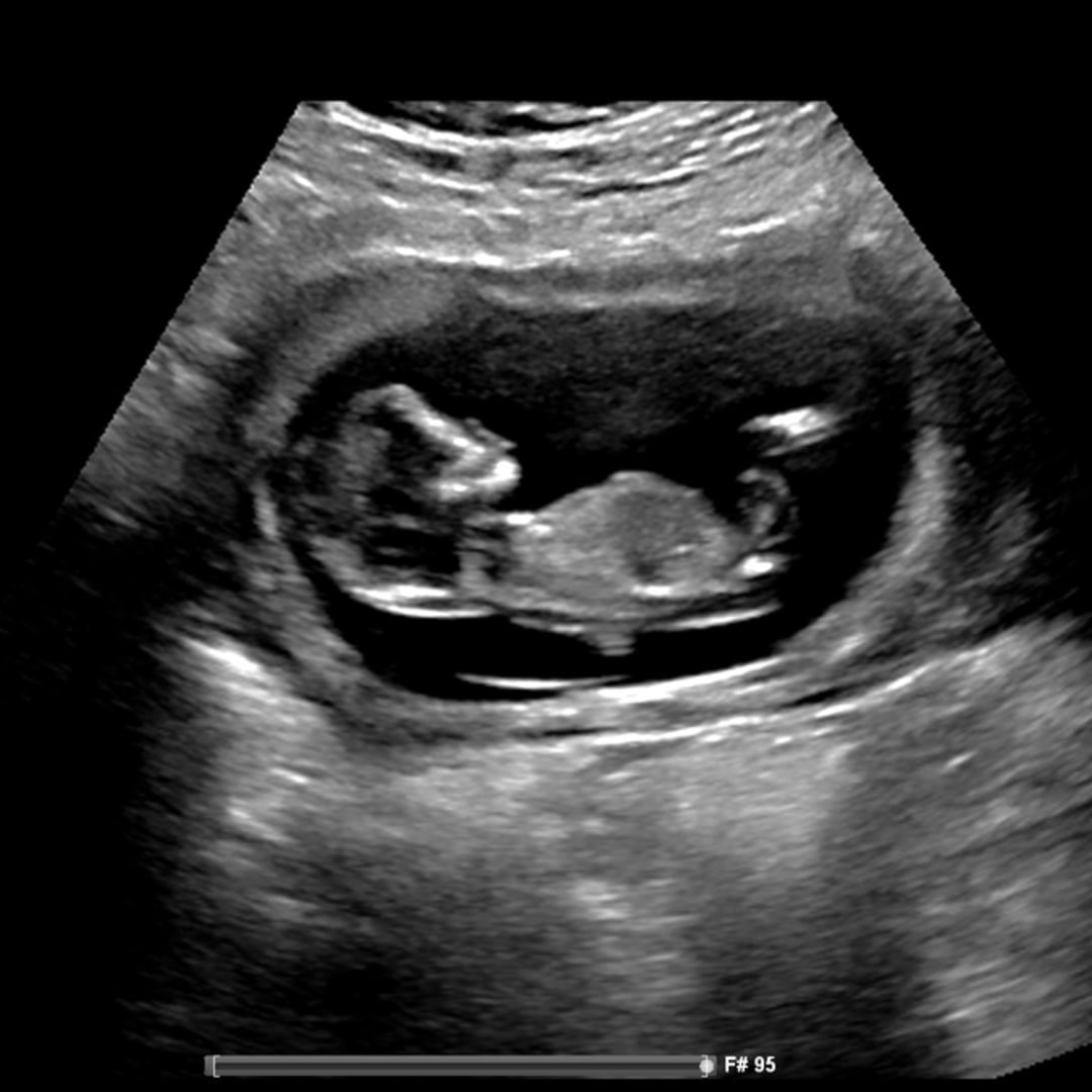 Photo shared by Vanessa for their Babylist baby registry.