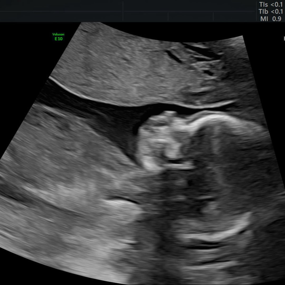 Photo shared by Meghan for their Babylist baby registry.