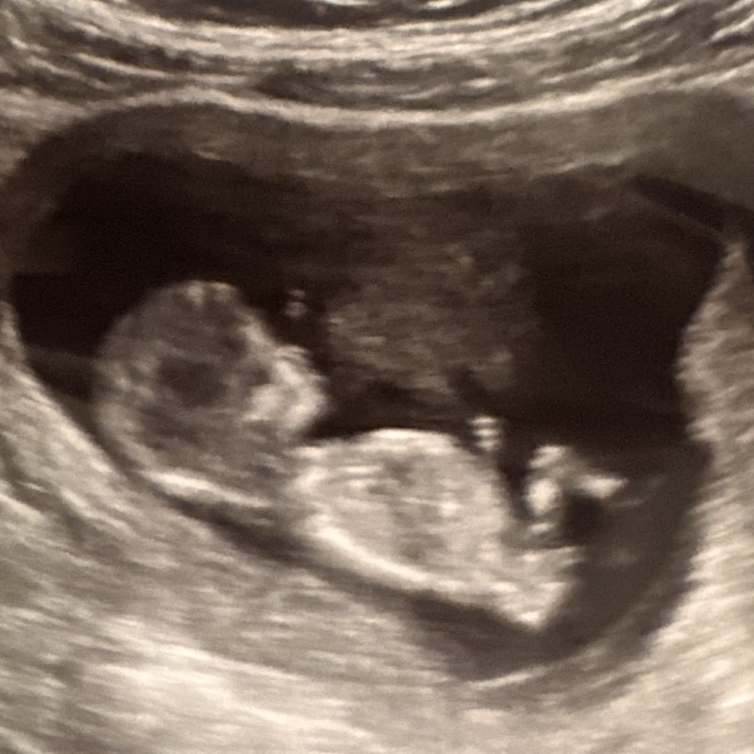 Photo shared by Alli for their Babylist baby registry.