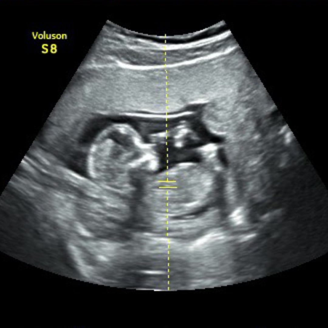 Photo shared by Dana for their Babylist baby registry.