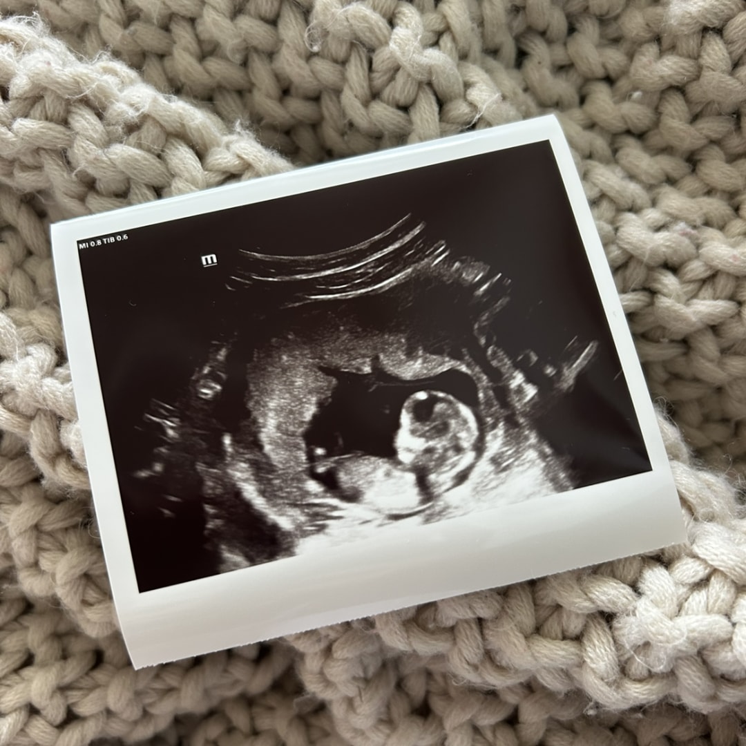Photo shared by Cate for their Babylist baby registry.