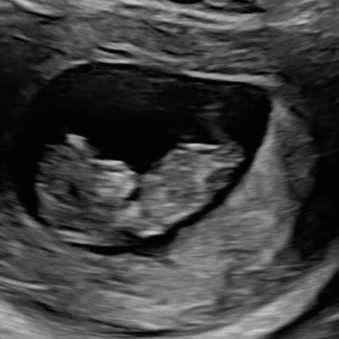 Photo shared by Jenna for their Babylist baby registry.