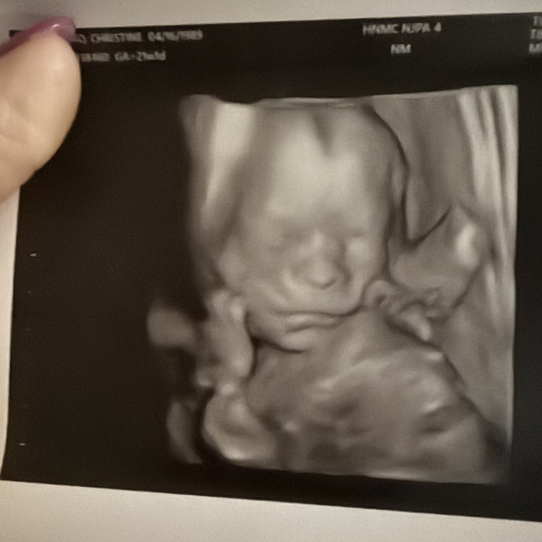 Photo shared by Christine for their Babylist baby registry.