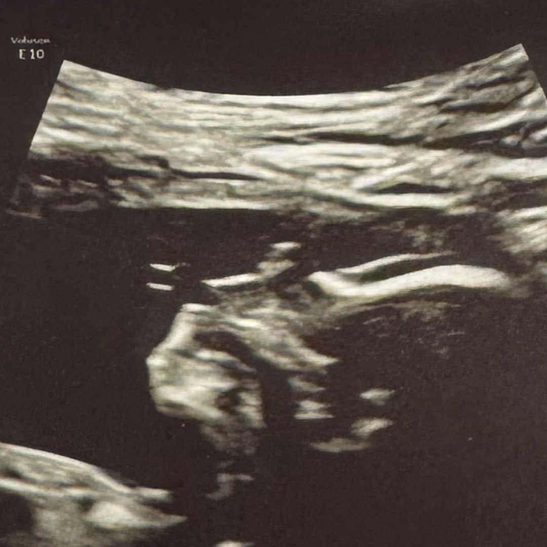 Photo shared by Josy for their Babylist baby registry.