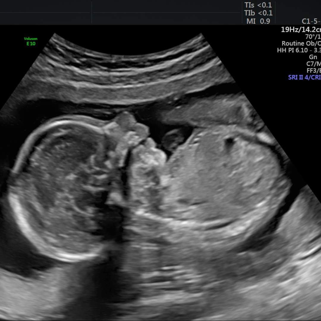 Photo shared by Katrina for their Babylist baby registry.