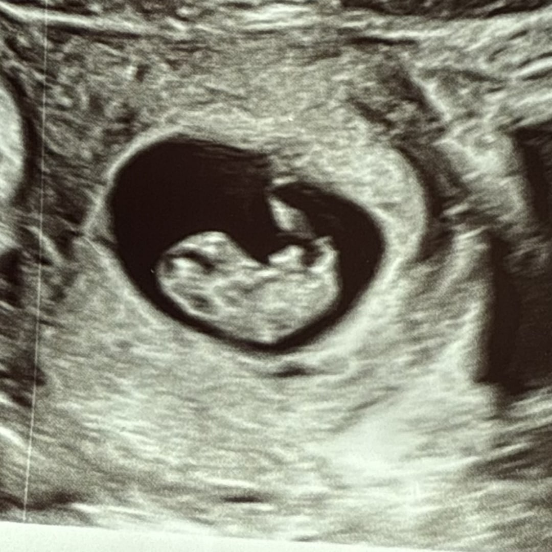 Photo shared by Mannibell for their Babylist baby registry.