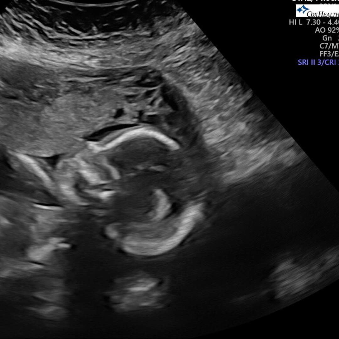 Photo shared by Ashley for their Babylist baby registry.