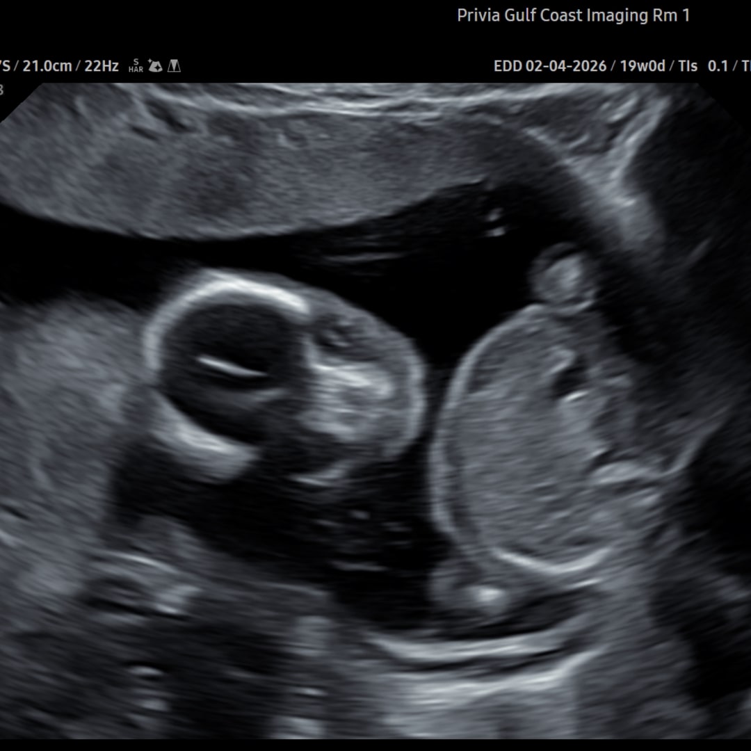 Photo shared by Presleigh for their Babylist baby registry.