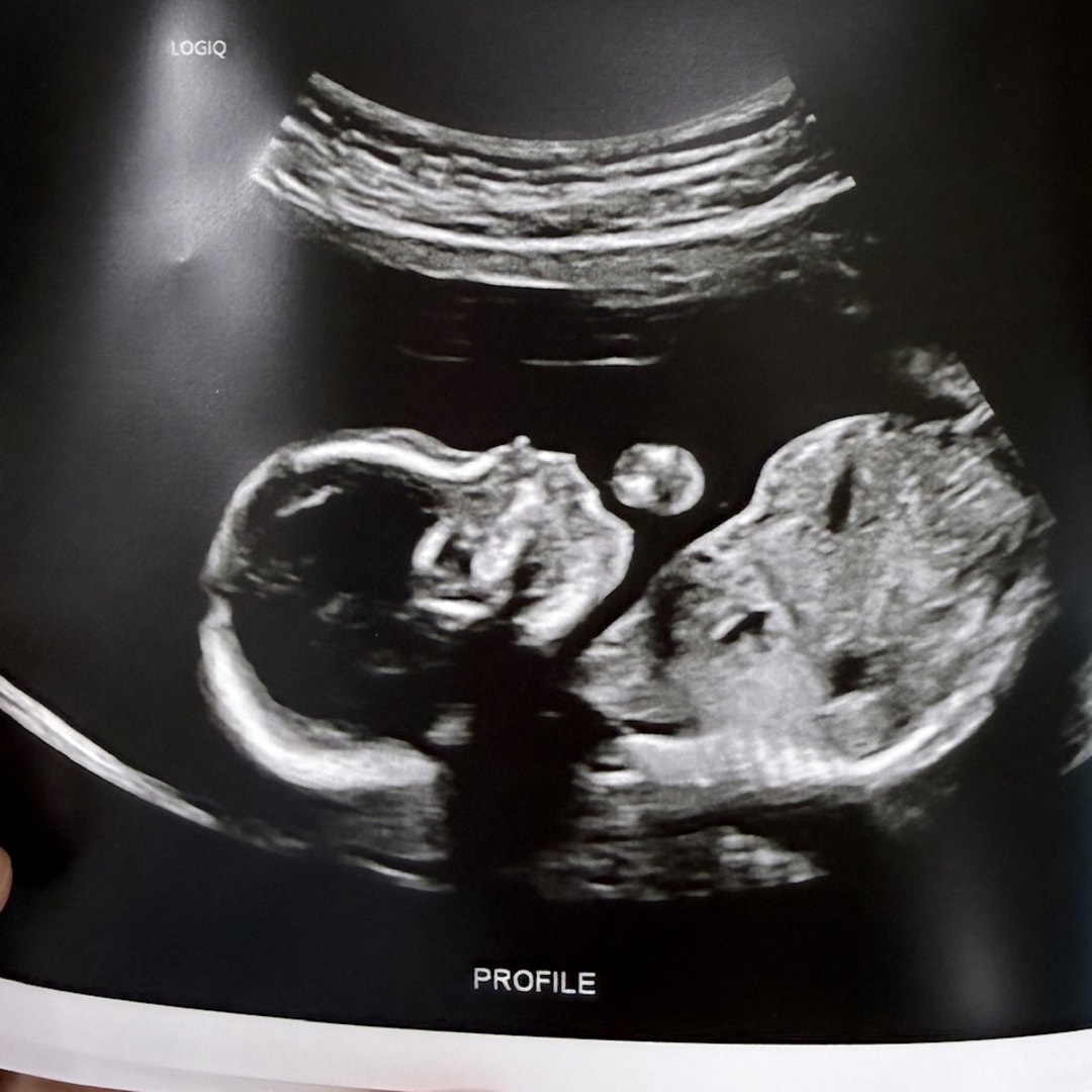 Photo shared by Ava for their Babylist baby registry.