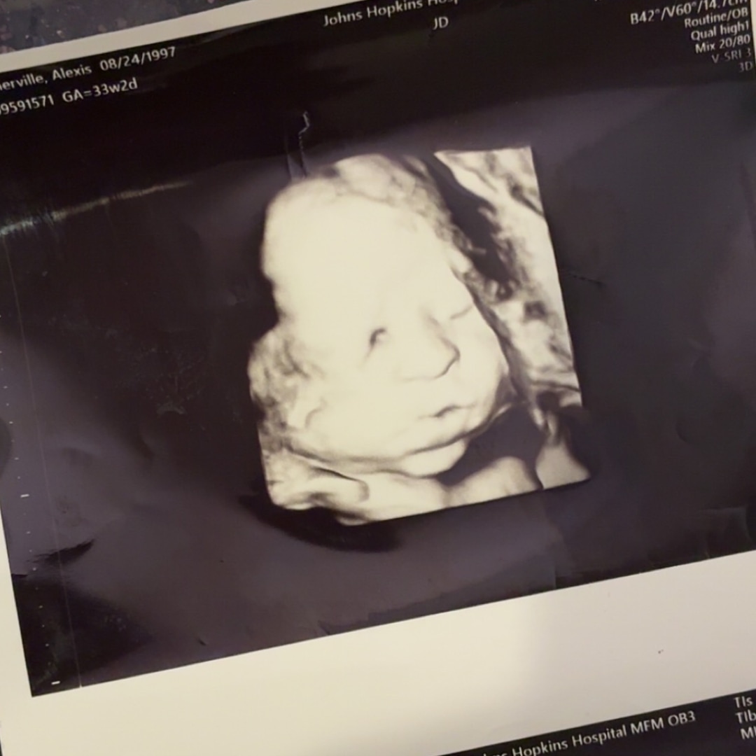 Photo shared by Alexis for their Babylist baby registry.