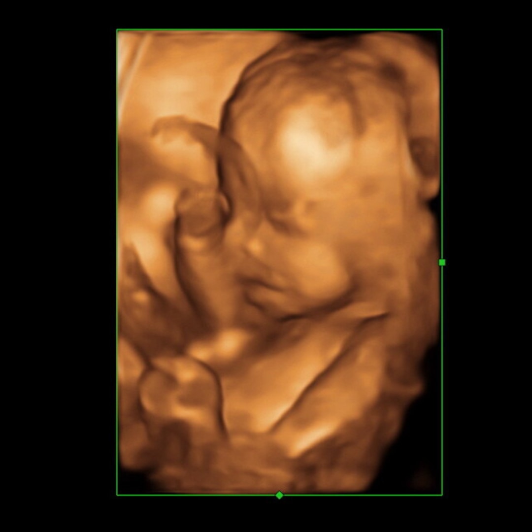 Photo shared by Addison for their Babylist baby registry.
