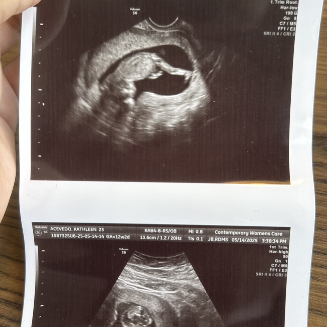 Photo shared by Kathleen for their Babylist baby registry.