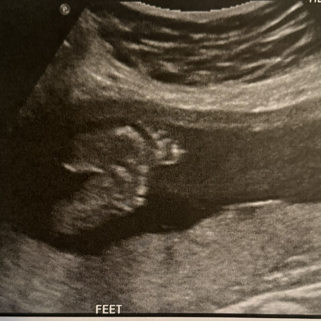 Photo shared by Mireya for their Babylist baby registry.