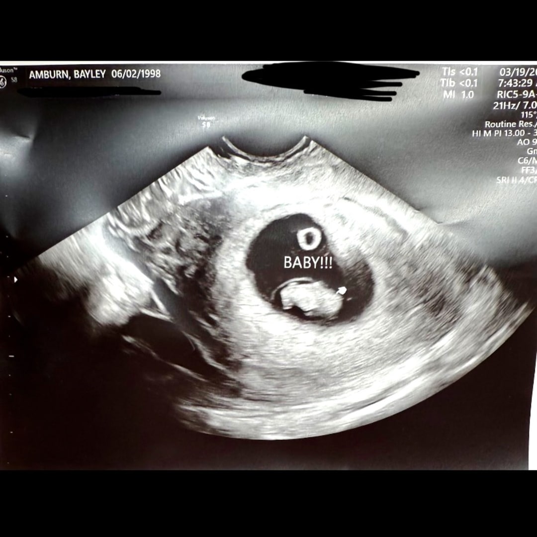 Photo shared by Bayley for their Babylist baby registry.