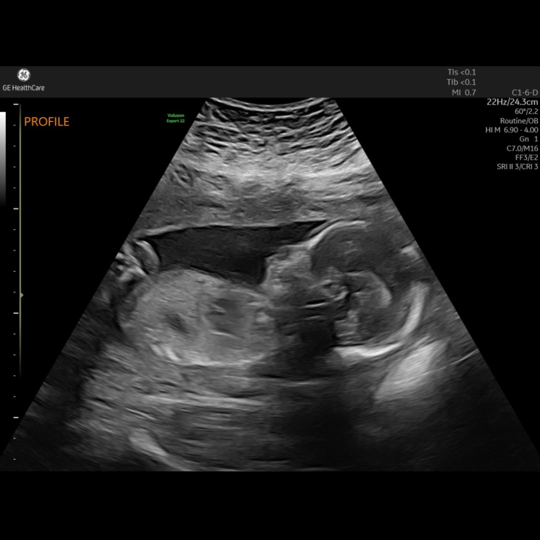 Photo shared by Crystal for their Babylist baby registry.