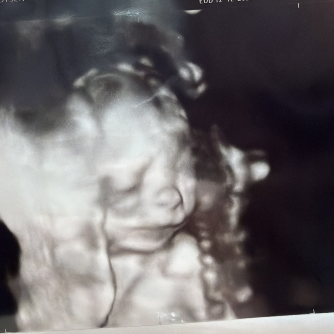 Photo shared by Madysen for their Babylist baby registry.