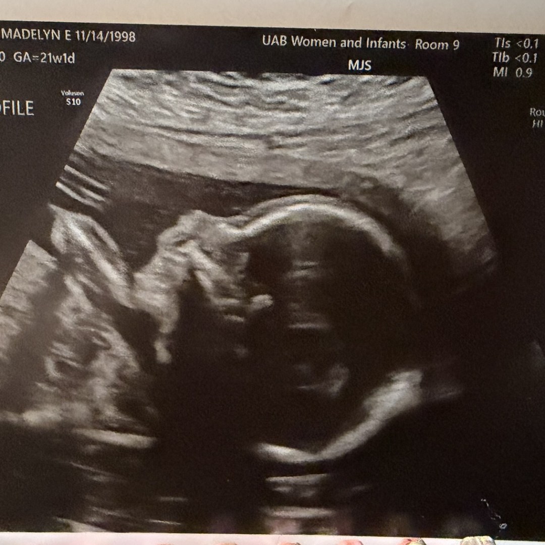 Photo shared by Madelyn for their Babylist baby registry.