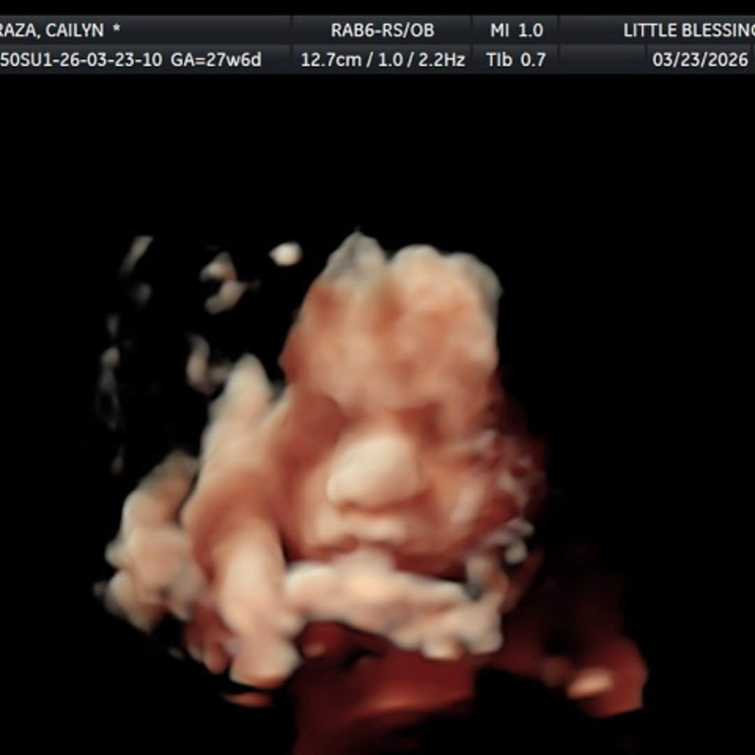 Photo shared by Cailyn for their Babylist baby registry.