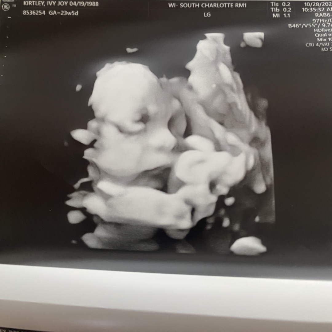 Photo shared by Ivy for their Babylist baby registry.