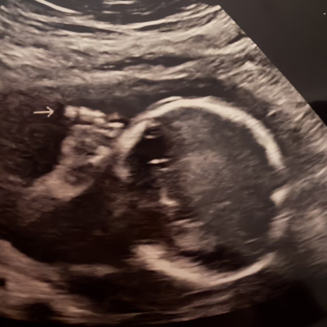 Photo shared by Abby for their Babylist baby registry.