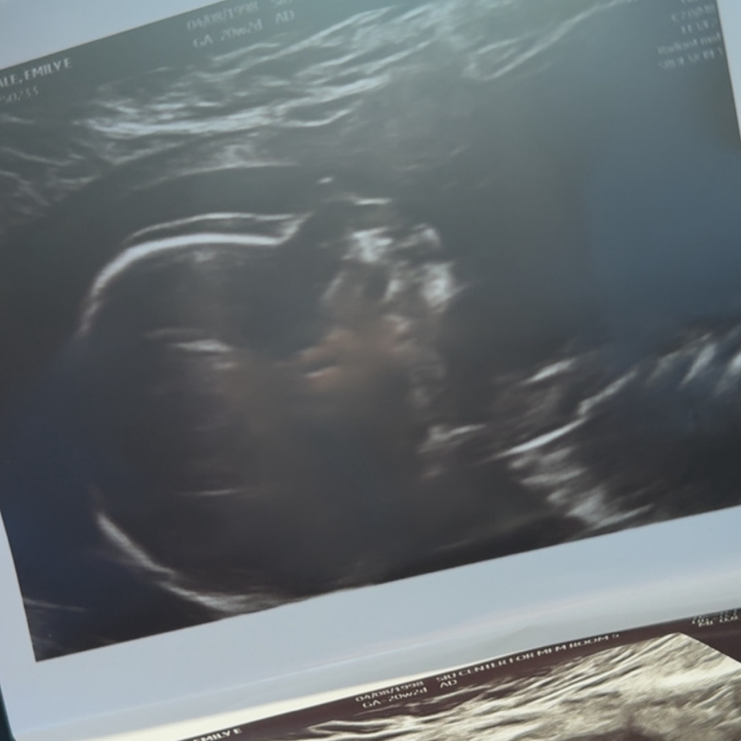 Photo shared by Emily for their Babylist baby registry.