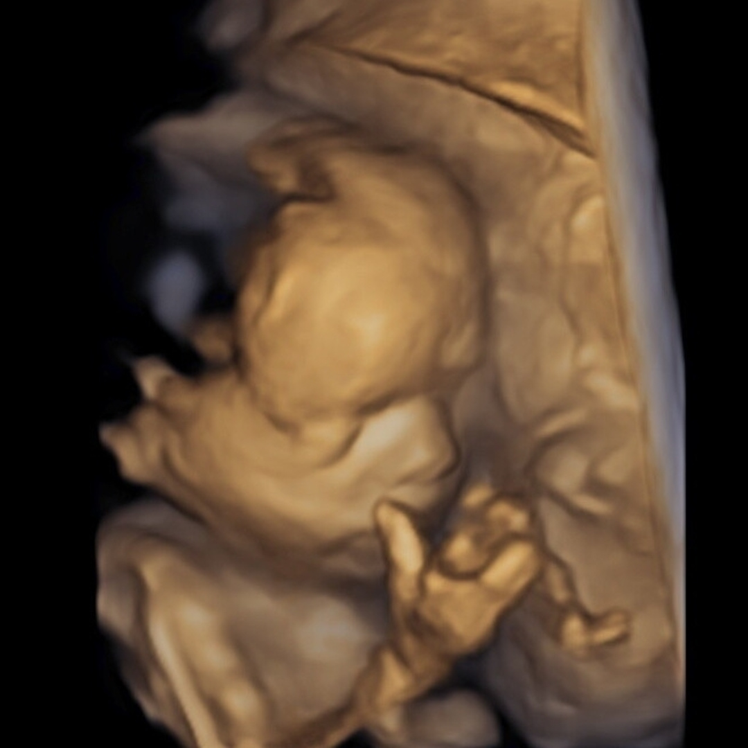 Photo shared by Abigail for their Babylist baby registry.