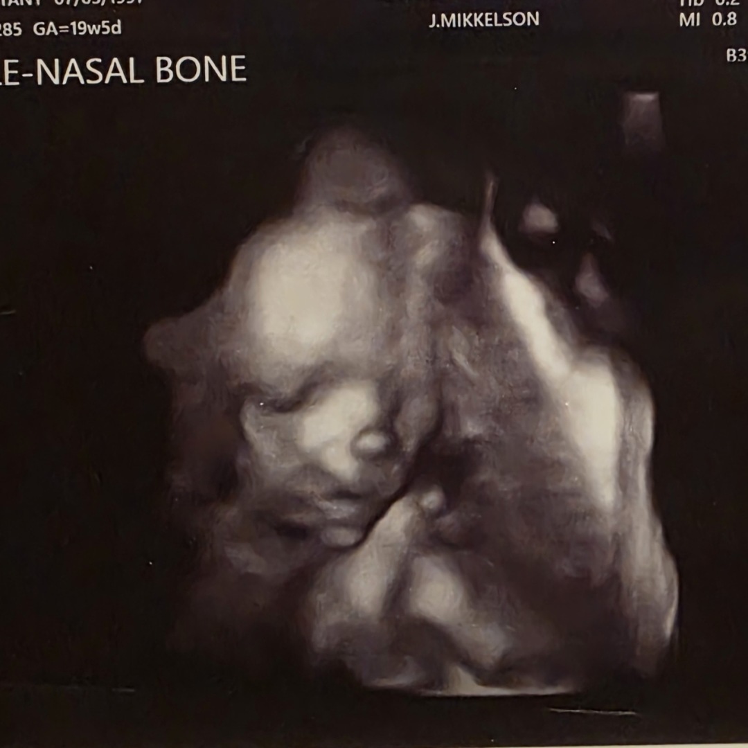 Photo shared by Brittany for their Babylist baby registry.