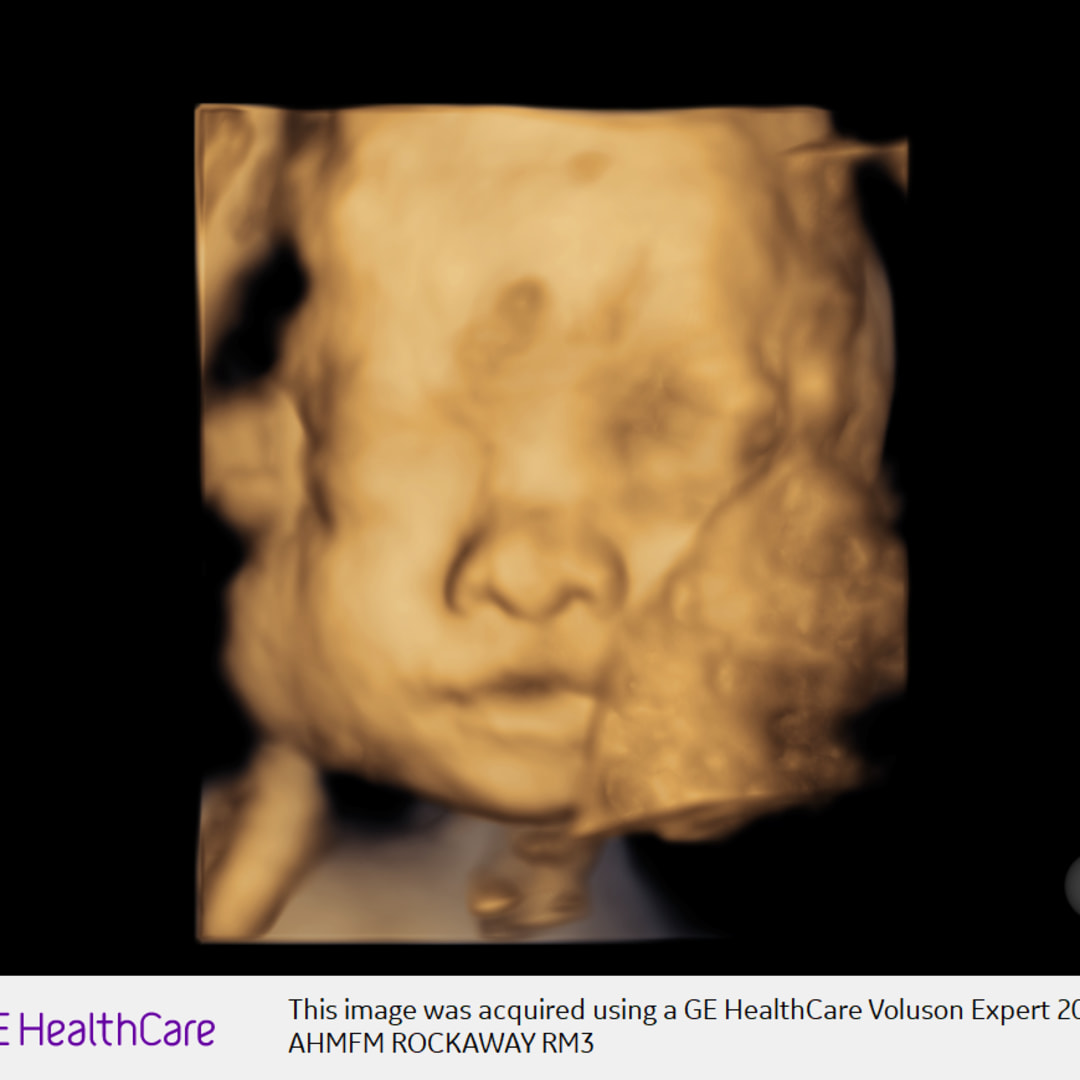 Photo shared by Susy for their Babylist baby registry.