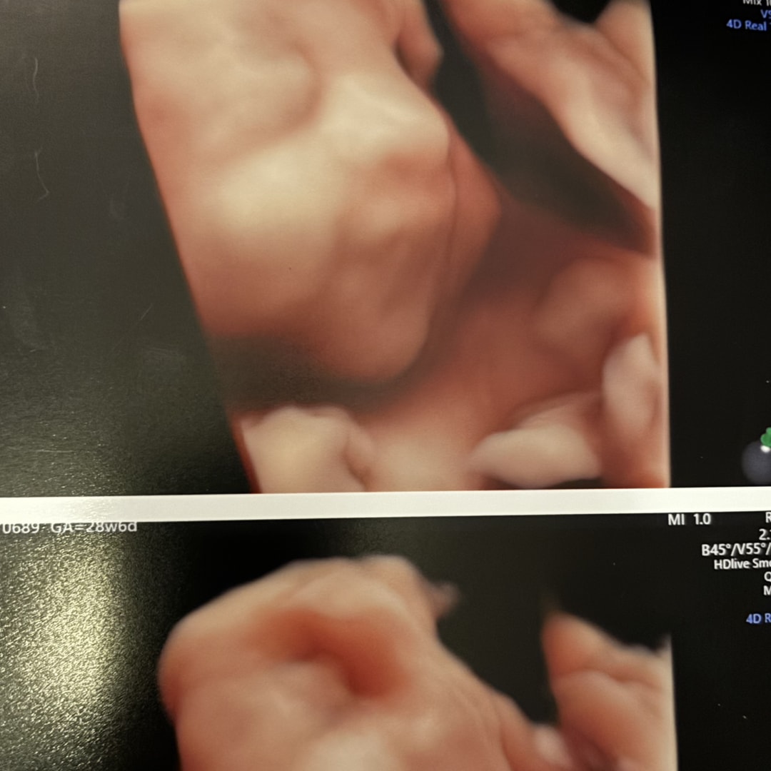 Photo shared by Kayla for their Babylist baby registry.