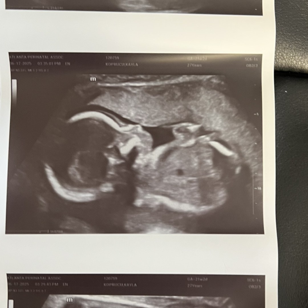 Photo shared by Kayla for their Babylist baby registry.