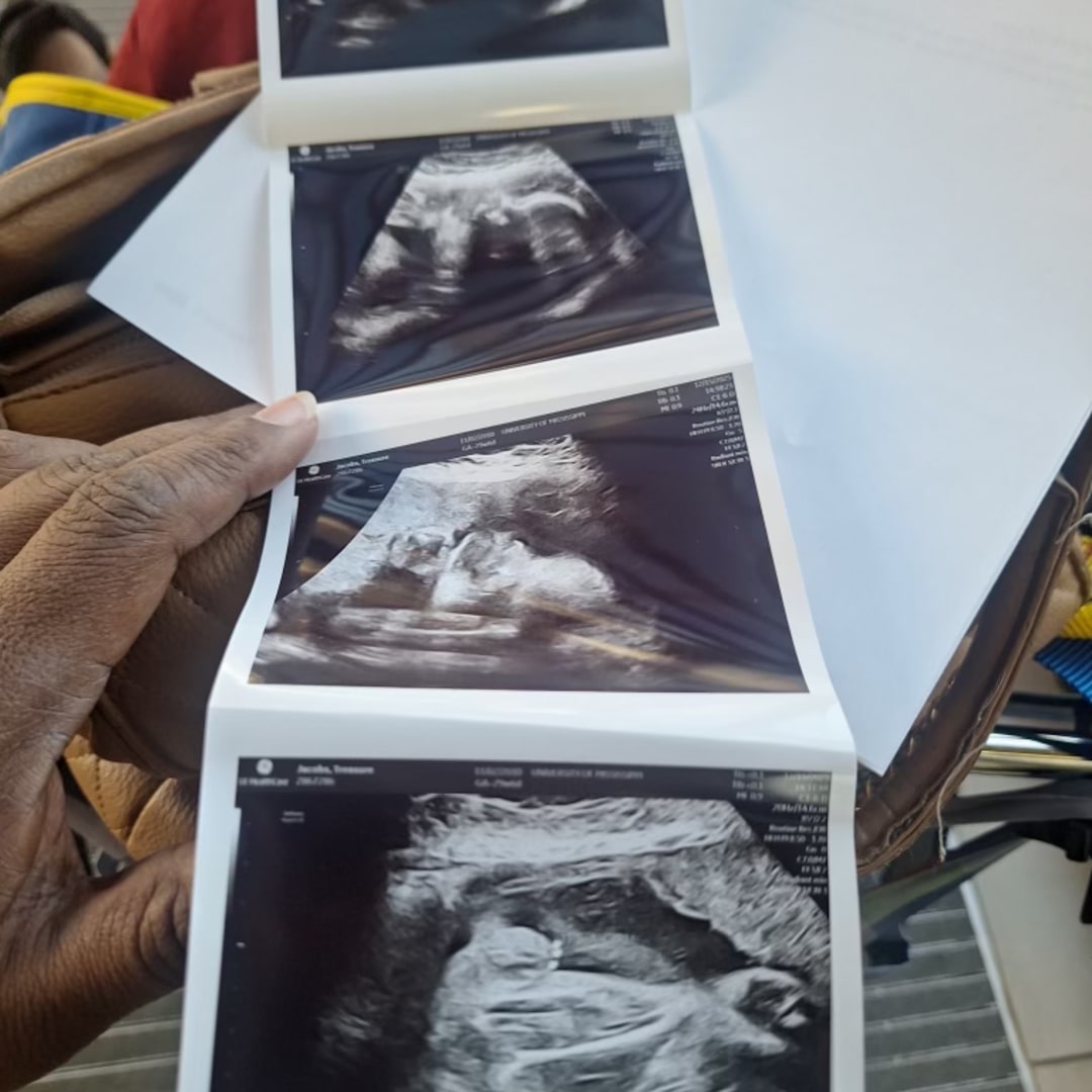 Photo shared by Treasure for their Babylist baby registry.