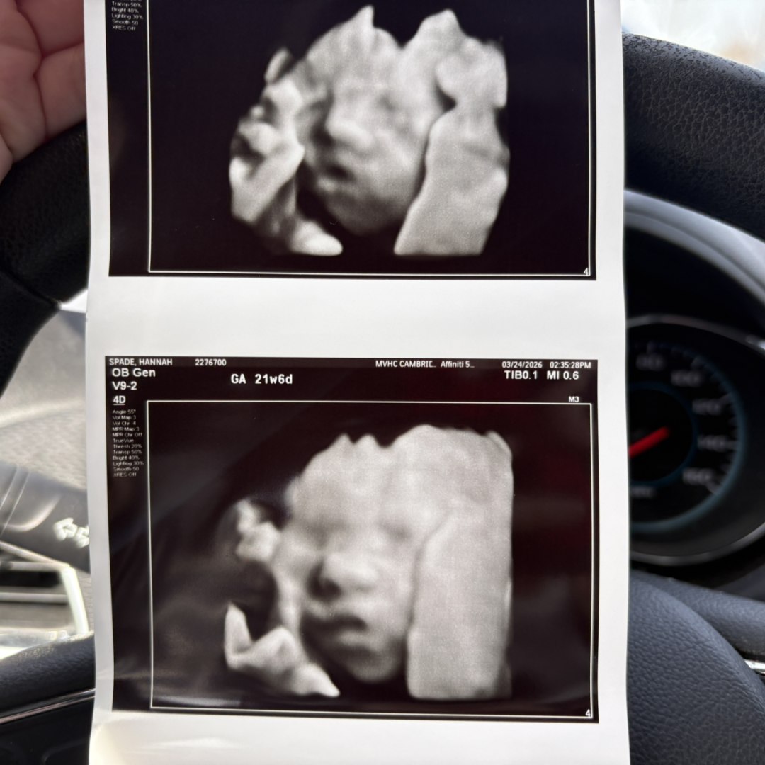 Photo shared by Hannah for their Babylist baby registry.