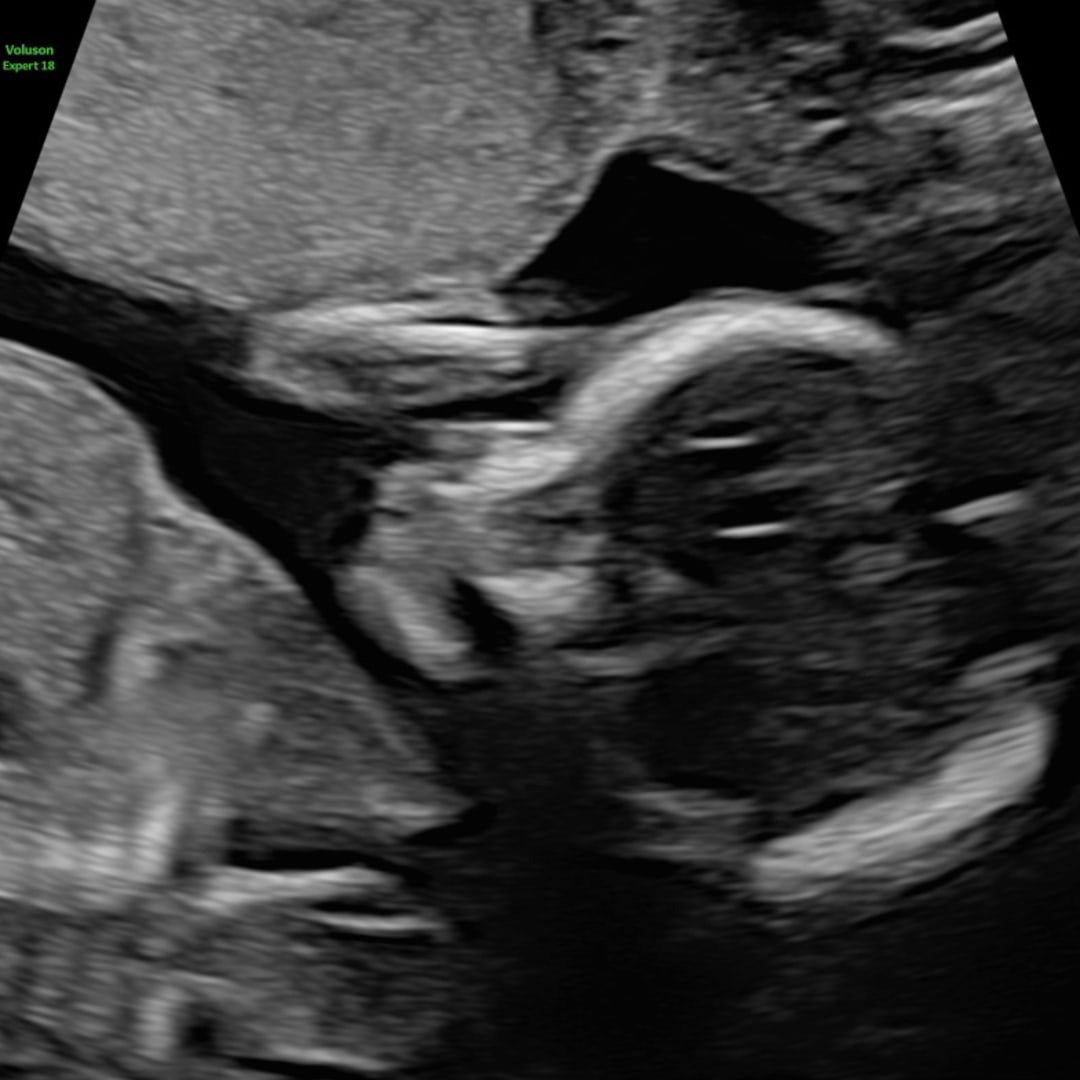 Photo shared by Ashley for their Babylist baby registry.